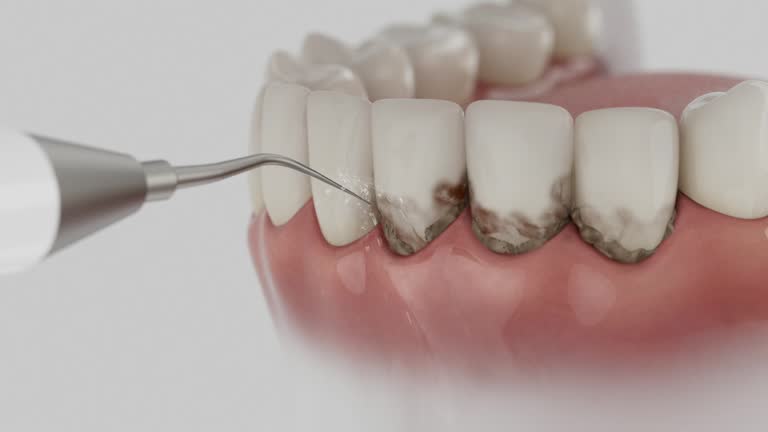 Trusted Teeth Cleaning And Checkup service in Farmersville, TX - Dentist Open Now